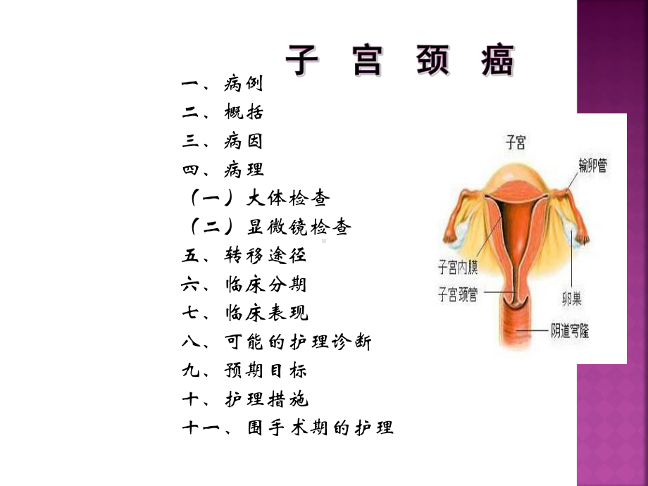 子宫颈癌的护理查房PPT课件.ppt_第2页