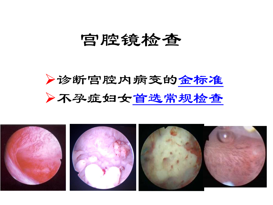 宫腔镜手术新进展课件.ppt_第3页