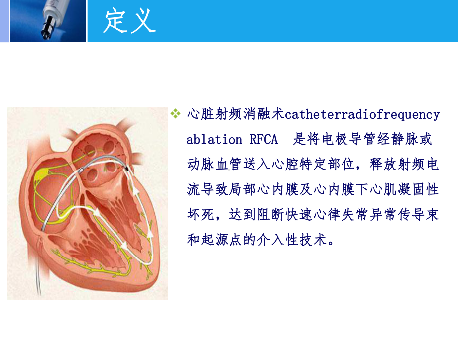 射频消融术的护理ppt课件.ppt_第3页