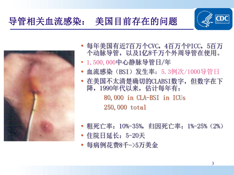 导管相关性血流感染预防和护理课件.pptx_第3页