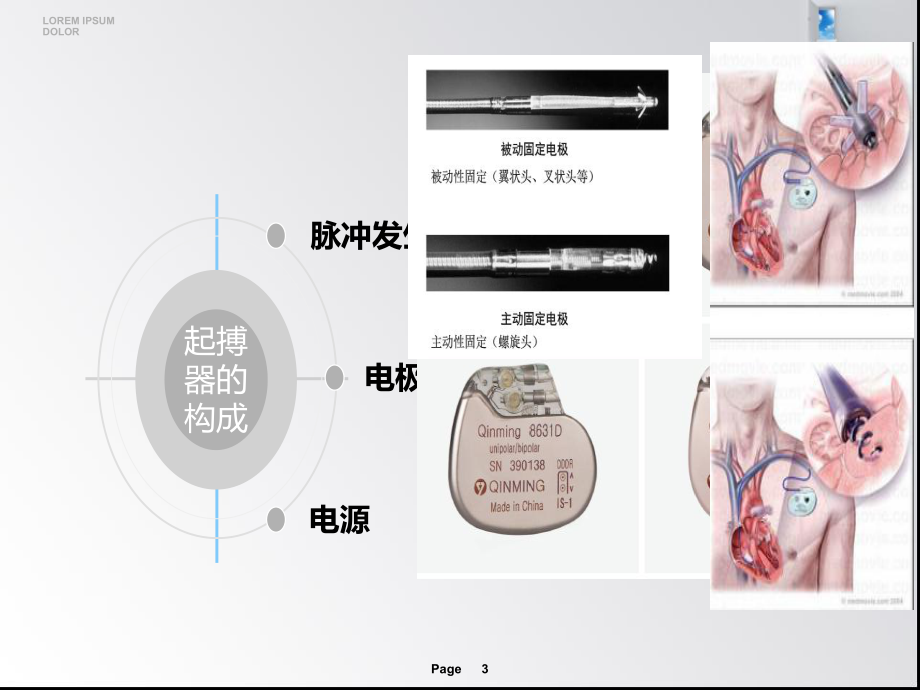 永久性心脏起搏器植入术后护理课件.ppt（24页）_第3页