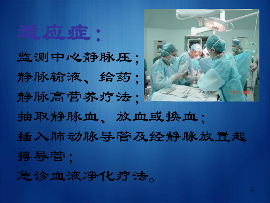 深静脉穿刺置管术PPT课件.ppt（75页）_第3页