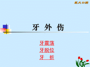 牙外伤PPT课件.ppt（27页）