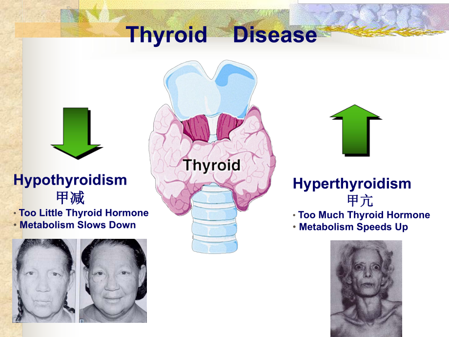甲状腺激素-ppt课件.ppt_第2页