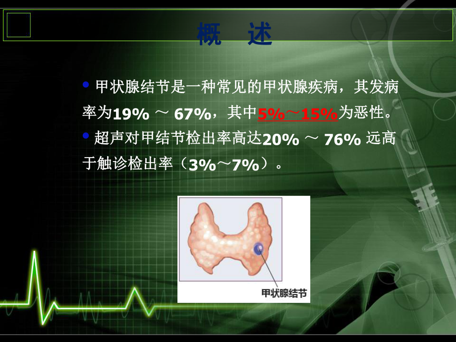 甲状腺结节细针穿刺课件.ppt_第2页