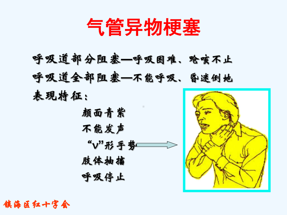 现场应急救护知识讲座(老人)课件.ppt_第3页