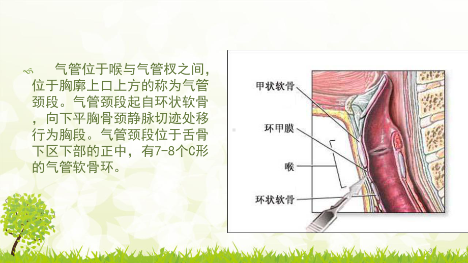 气管切开患者护理PPT课件.ppt（19页）_第3页