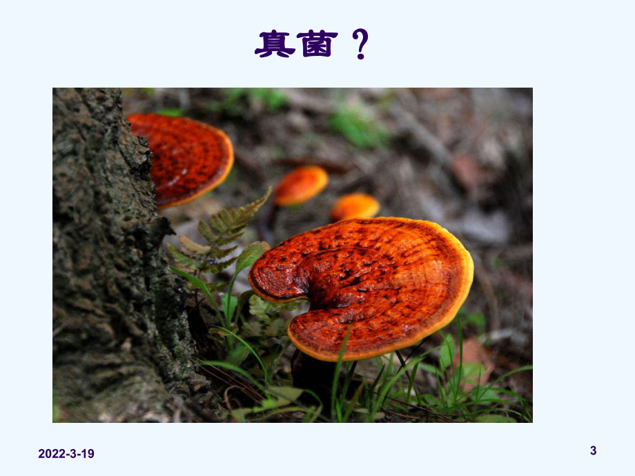 真菌感染性皮肤病课件.ppt_第3页