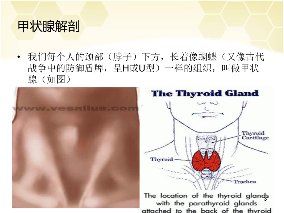 甲状腺手术PPT课件.ppt_第3页