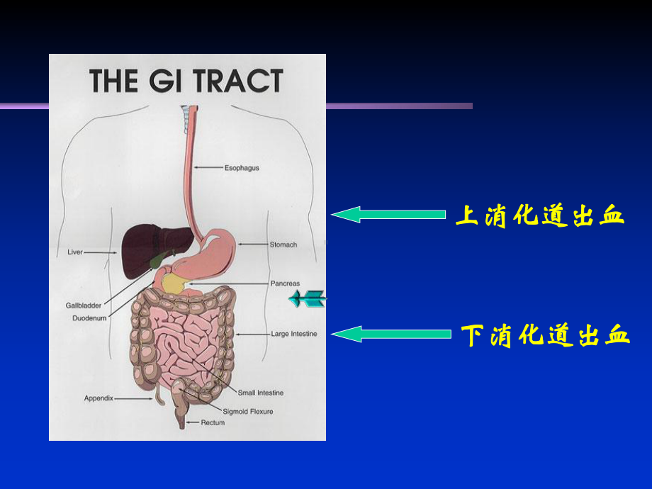 消化道出血PPT课件.ppt（97页）_第2页