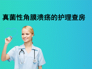 真菌性角膜溃疡的护理查房PPT课件.ppt