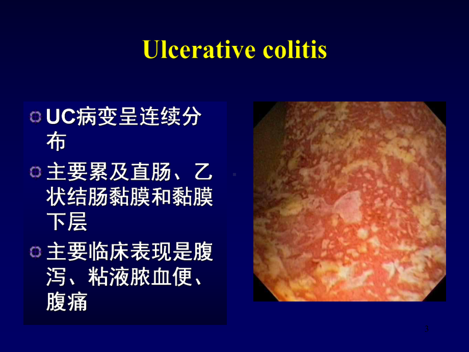 炎症性肠病的诊断与治疗PPT课件.ppt（65页）_第3页