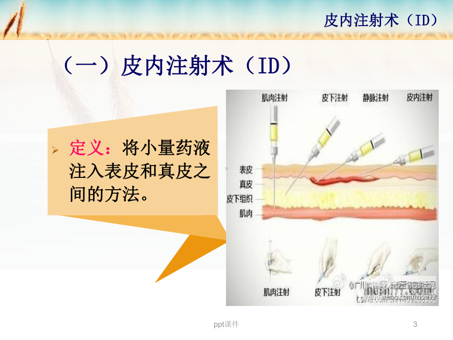 皮内注射-ppt课件.ppt_第3页