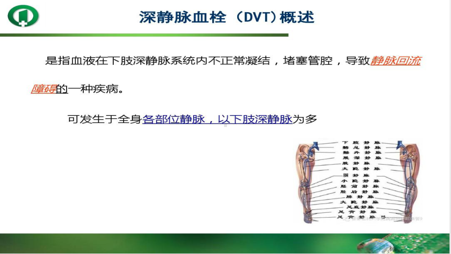 深静脉血栓预防及处理PPT课件.ppt（16页）_第2页