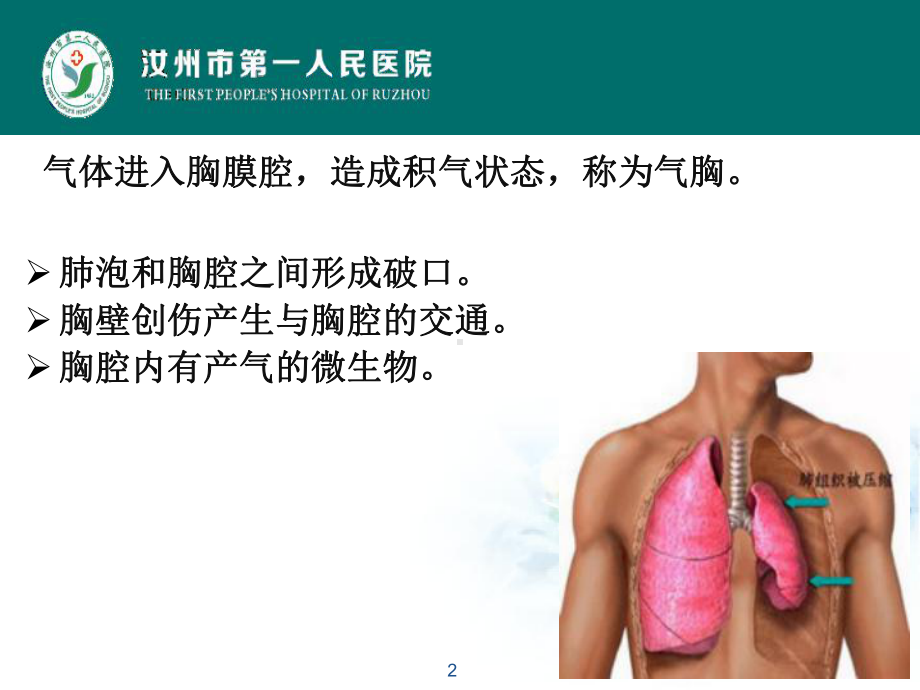 气胸健康教育PPT课件.ppt（30页）_第2页