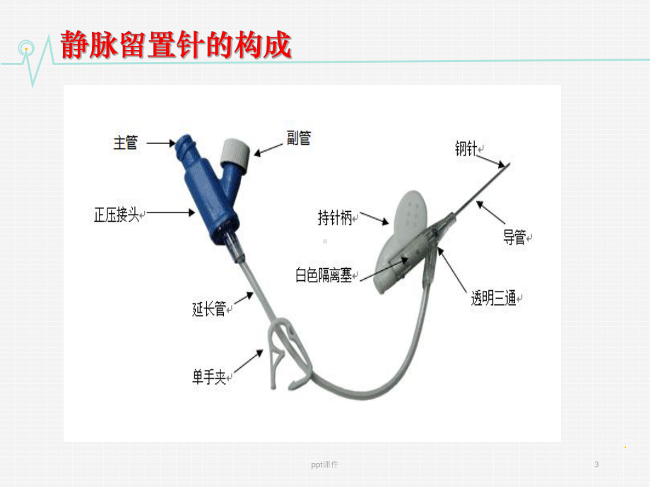 留置针穿刺技巧-ppt课件.ppt_第3页