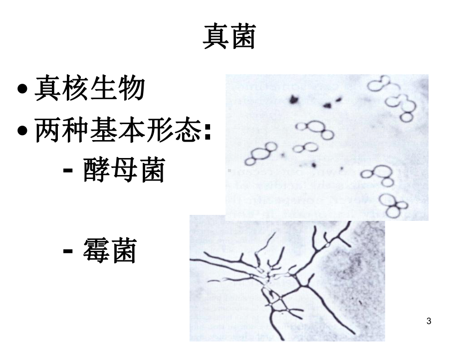 真菌的分类与致病性PPT课件.ppt_第3页