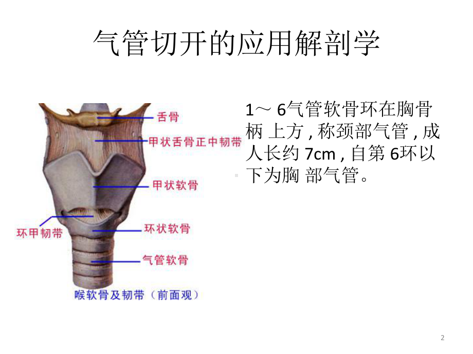 气管切开术PPT课件.ppt（26页）_第2页