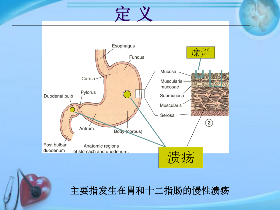 消化性溃疡-ppt课件.ppt（45页）_第2页