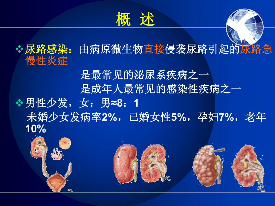 尿路感染病人护理-描述课件.ppt（76页）_第3页