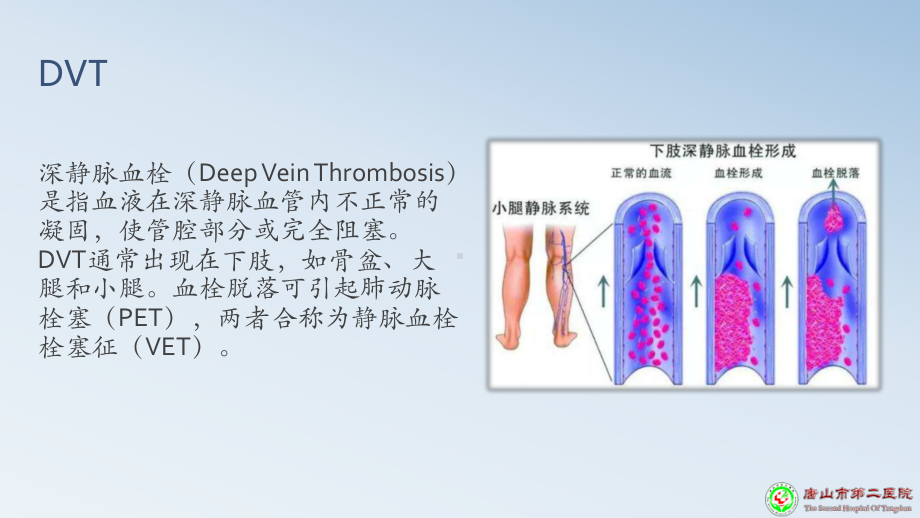 深静脉血栓预防PPT课件.pptx_第3页