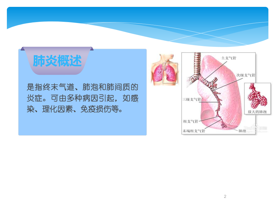 社区获得性肺炎的护理PPT课件.ppt_第2页