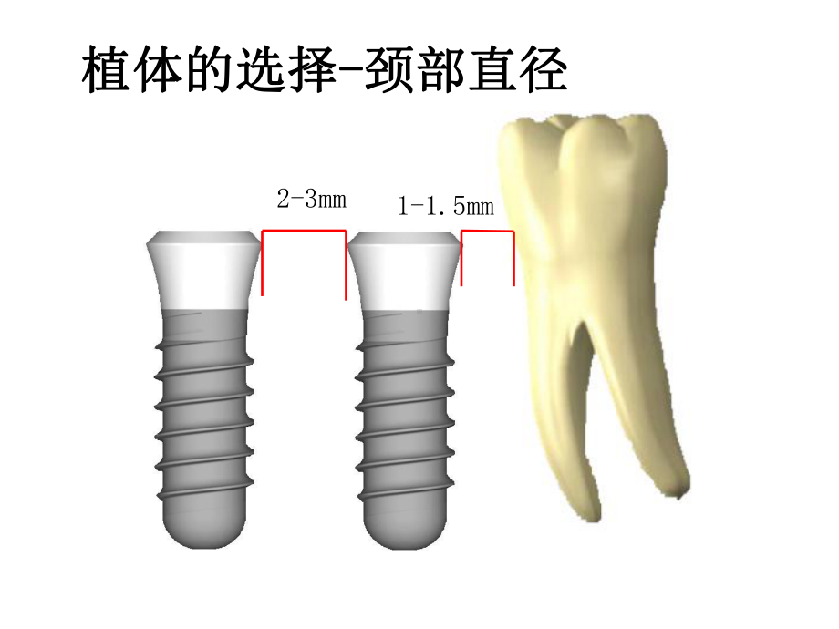 种植区骨量不足的处理ppt课件.ppt_第3页