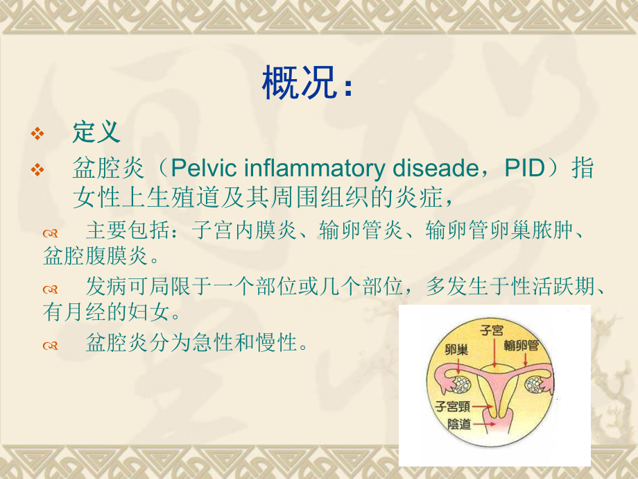 盆腔炎PPT课件.ppt_第2页