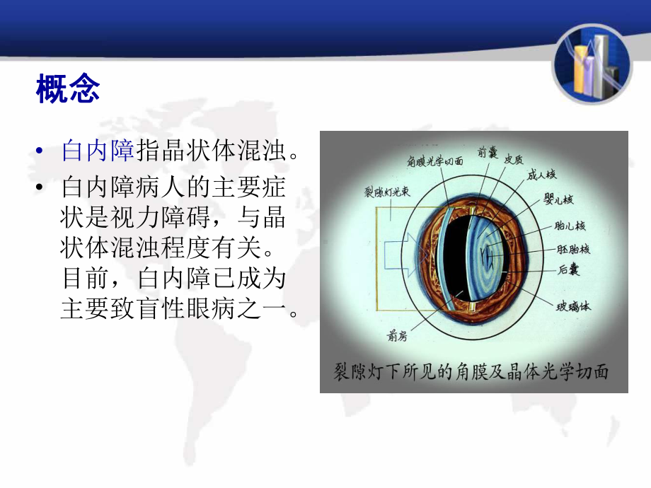 白内障护理PPT课件.ppt_第2页