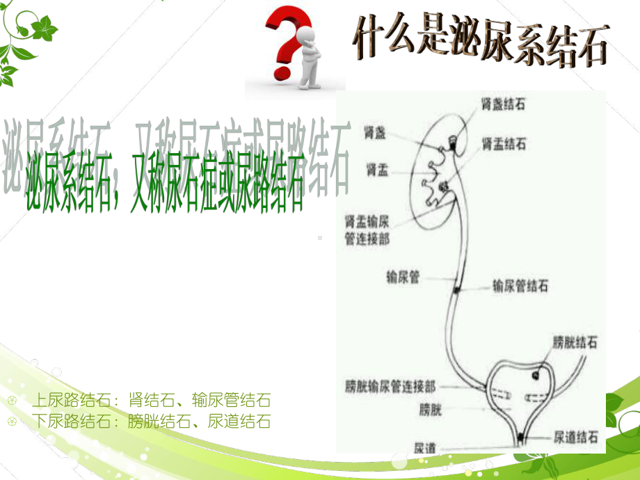 泌尿系结石健康教育-ppt课件.ppt_第2页