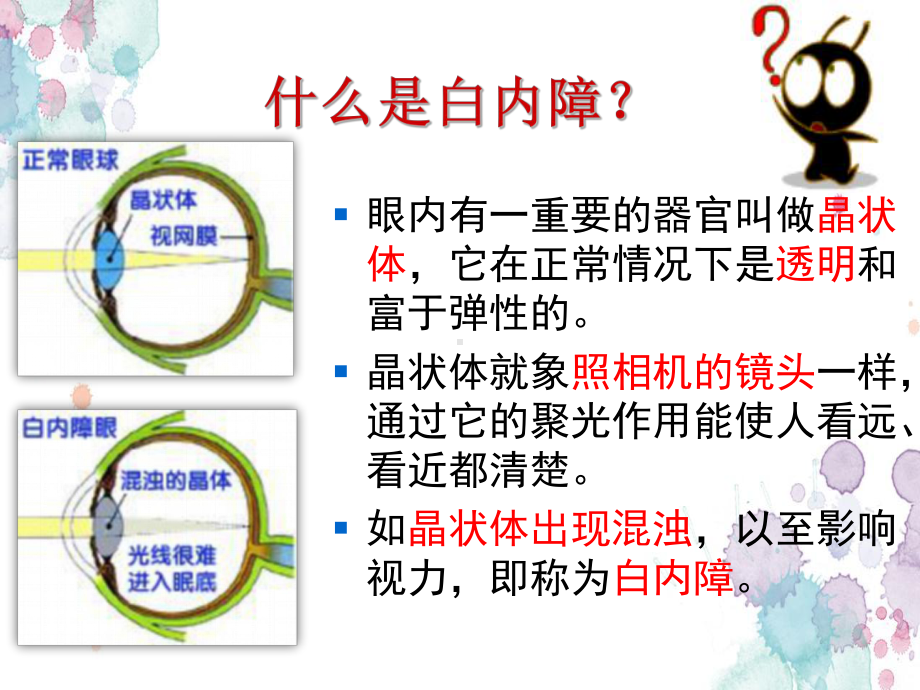 白内障科普讲座医学PPT课件.ppt_第3页