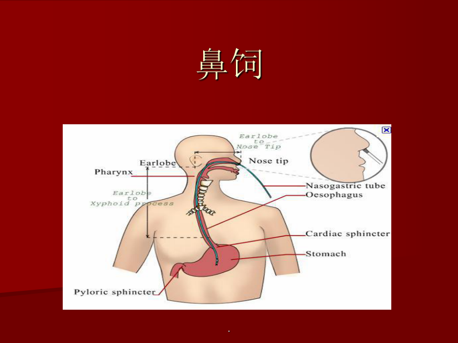 鼻饲PPT课件.ppt_第1页