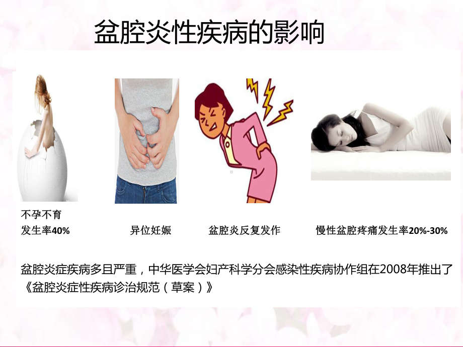 盆腔炎性疾病的治疗PPT课件.ppt_第2页