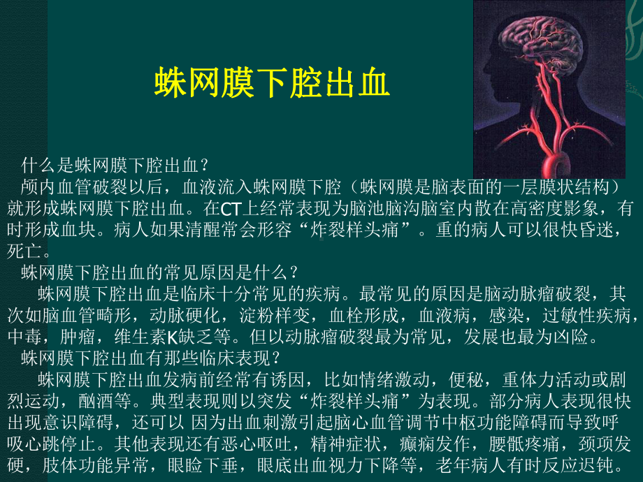 神经外科宣传栏PPT课件.ppt_第3页