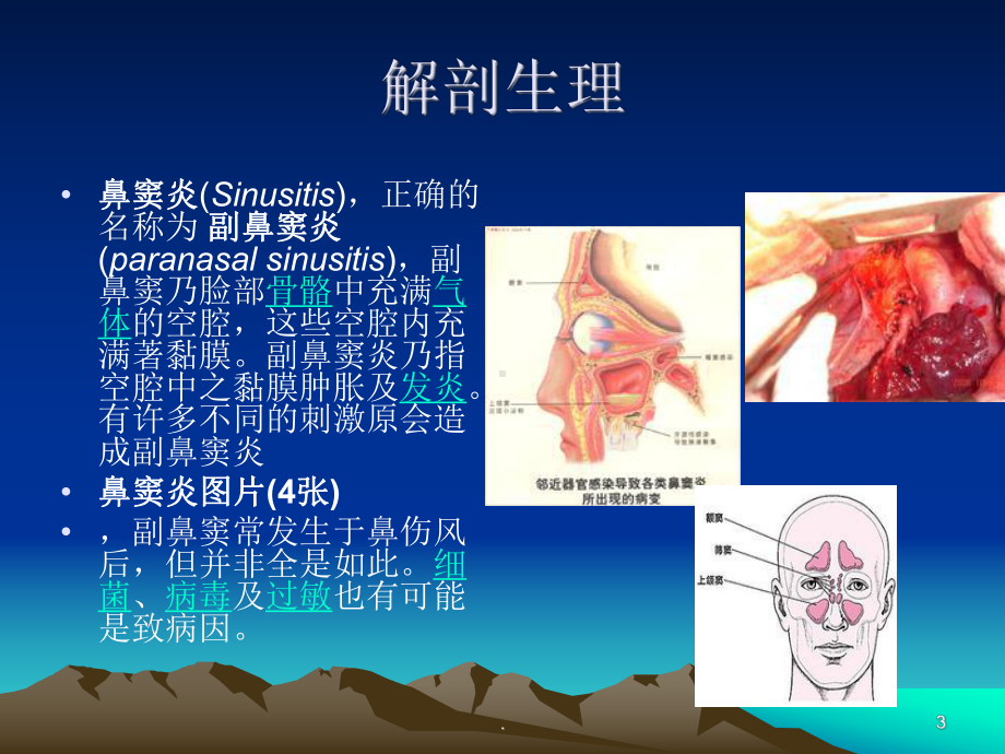 鼻窦炎的护理ppt演示课件ppt演示课件.ppt_第3页