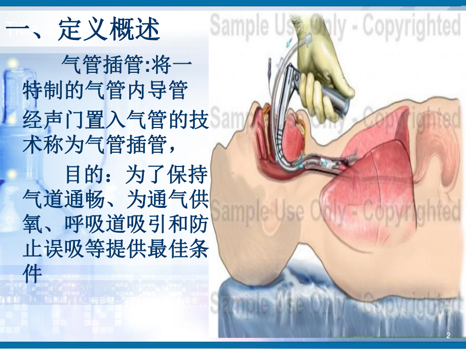 气管插管护理PPT幻灯片课件.ppt_第2页