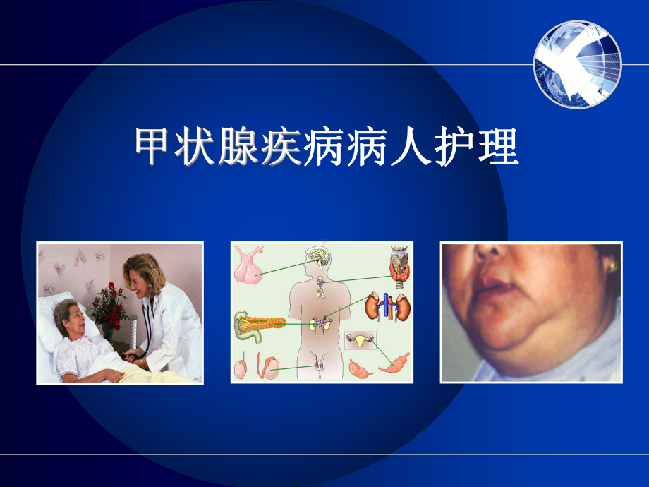 甲状腺疾病护理PPT课件.ppt_第1页