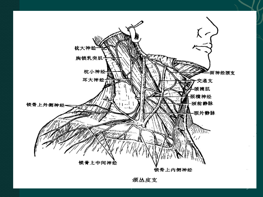 臂丛神经阻滞麻醉ppt演示课件.ppt_第3页