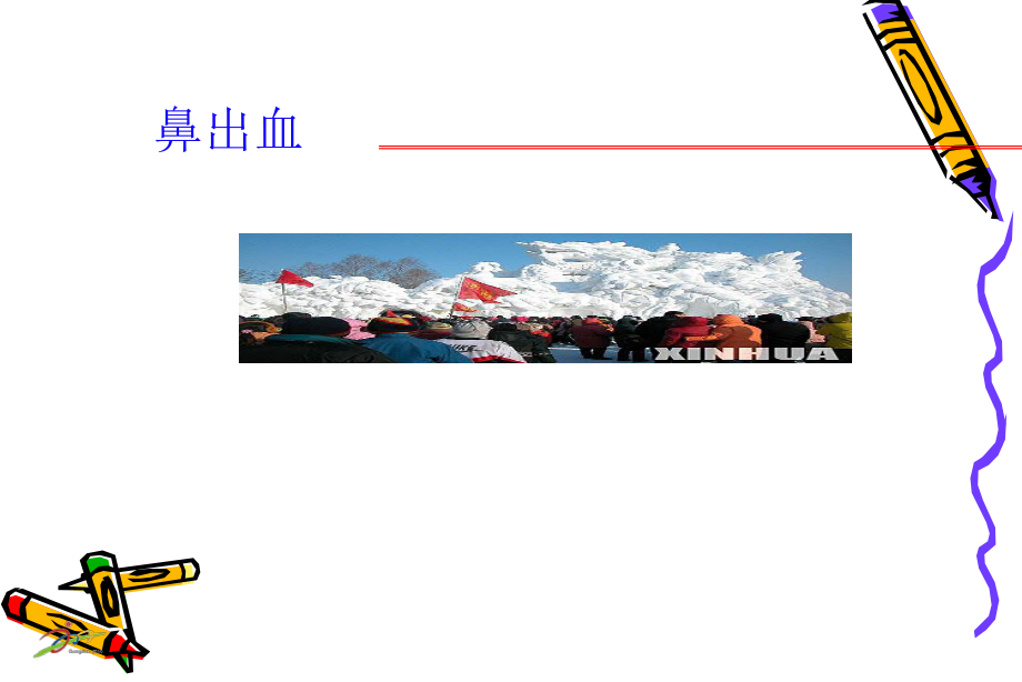 鼻出血课件.ppt_第1页