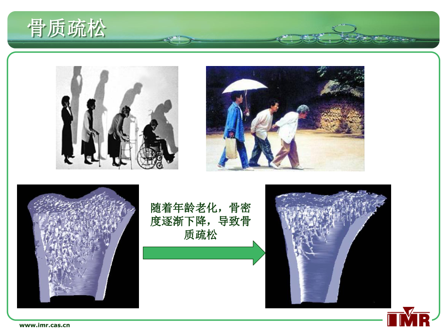 补钙的同时请补镁课件.ppt_第2页