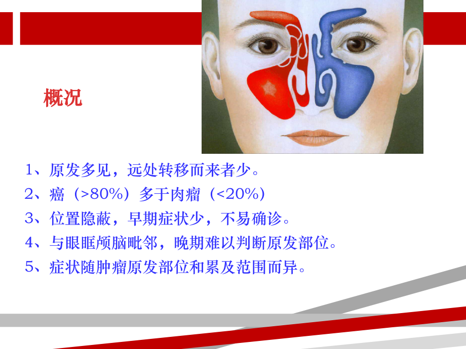 鼻腔鼻窦恶性肿瘤.ppt课件.ppt_第3页