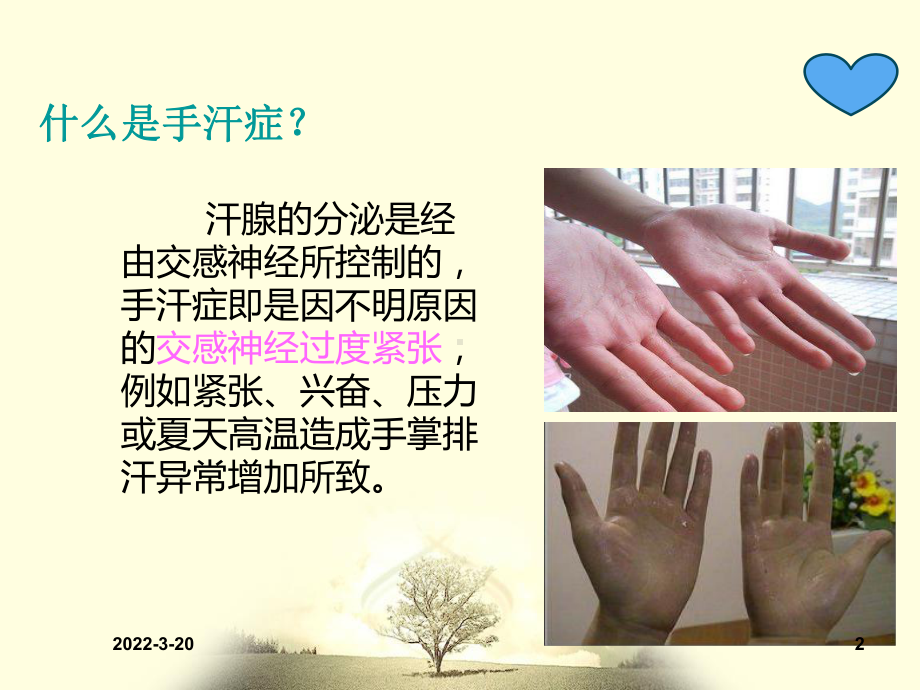 手汗症PPT参考课件.ppt_第2页