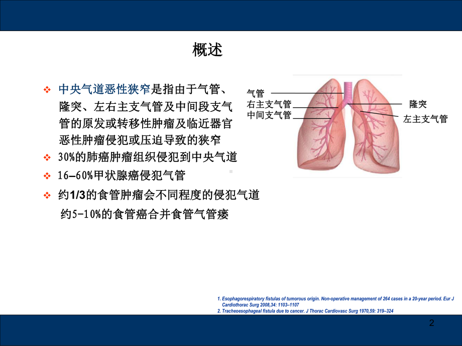 气道支架PPT学习课件.ppt_第2页