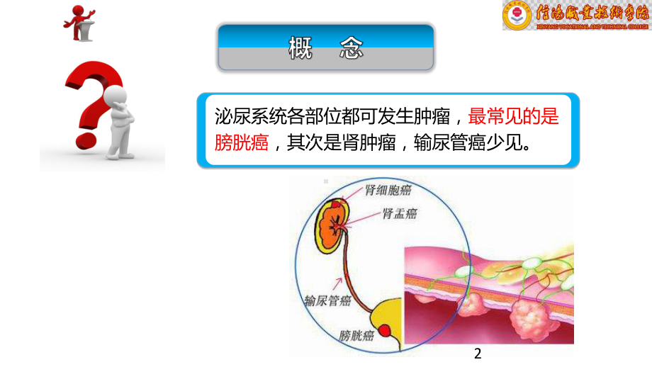 章泌尿、男性生殖系统患者的护理PPT课件.ppt_第2页