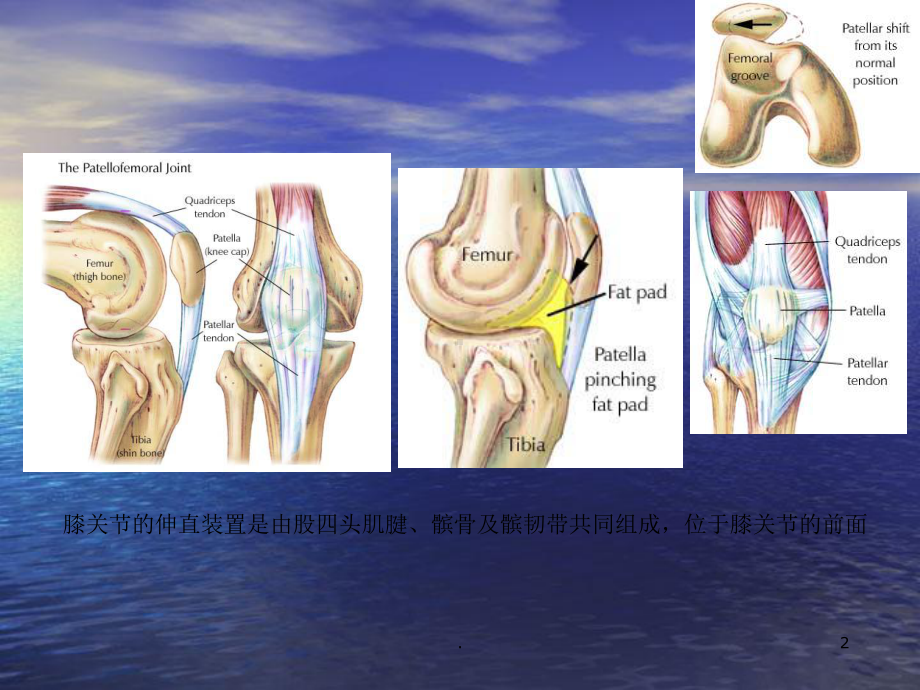 髌骨骨折康复ppt演示课件.ppt_第2页