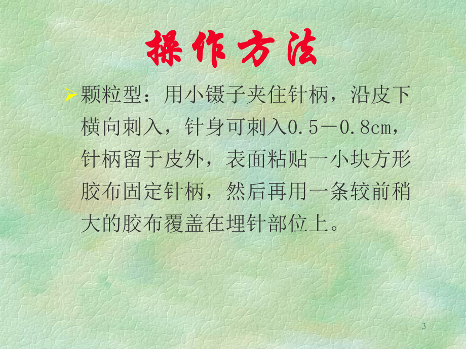 皮内针电针穴位注射ppt课件.ppt_第3页