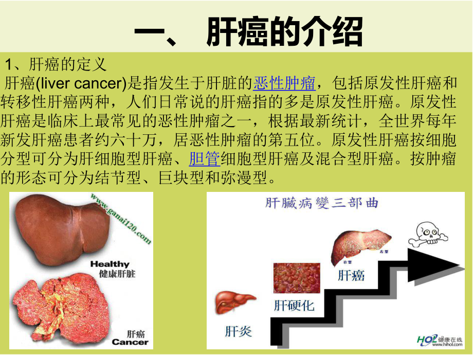 肝癌免疫治疗PPT课件.ppt_第3页