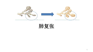 肺复张PPT优质课件.ppt