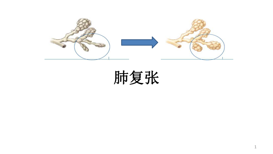 肺复张PPT优质课件.ppt_第1页