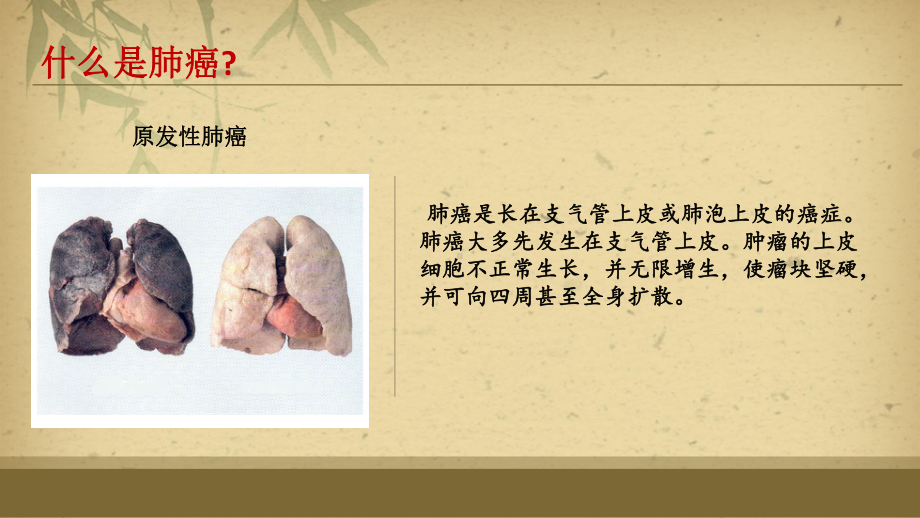 肺癌的护理常规(PPT课件).ppt_第3页